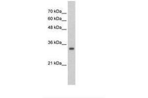 Image no. 1 for anti-Zinc Finger Protein 227 (ZNF227) (AA 301-350) antibody (ABIN203042) (ZNF227 Antikörper  (AA 301-350))