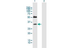 Western Blot analysis of SDC4 expression in transfected 293T cell line by SDC4 MaxPab polyclonal antibody. (SDC4 Antikörper  (AA 1-198))