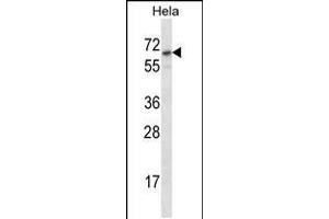Western blot analysis in Hela cell line lysates (35ug/lane). (STS Antikörper  (C-Term))