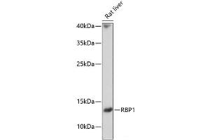 Western blot analysis of extracts of Rat liver using RBP1 Polyclonal Antibody at dilution of 1:1000. (RBP1 Antikörper)