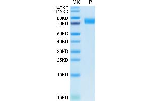 Human B7-H6 on Tris-Bis PAGE under reduced condition. (B7-H6 Protein (AA 25-262) (Fc Tag))