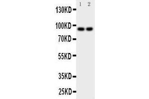Anti-MALT1 antibody, Western blotting Lane 1: MCF-7 Cell Lysate Lane 2: HELA Cell Lysate (MALT1 Antikörper  (C-Term))