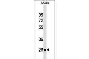 VB Antibody (C-term) 18906b western blot analysis in A549 cell line lysates (35 μg/lane). (VAPB Antikörper  (C-Term))