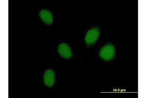 Immunofluorescence of purified MaxPab antibody to PHF16 on HeLa cell. (PHF16 Antikörper  (AA 1-823))