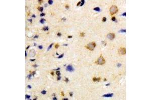Immunohistochemical analysis of NEK7 staining in human brain formalin fixed paraffin embedded tissue section. (NEK7 Antikörper)