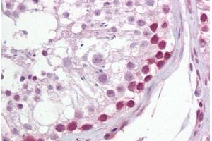 Anti-UNG antibody IHC staining of human testis. (UNG Antikörper  (AA 281-298))