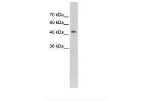 Image no. 1 for anti-Methyl CpG Binding Protein 2 (MECP2) (N-Term) antibody (ABIN203466) (MECP2 Antikörper  (N-Term))