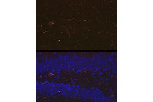 Immunofluorescence analysis of mouse brain using //IB Rabbit mAb (9776) at dilution of 1:100 (40x lens). (Iba1 Antikörper)