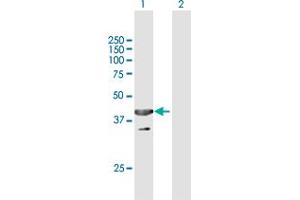 Western Blot analysis of UBXN1 expression in transfected 293T cell line by UBXN1 MaxPab polyclonal antibody. (UBXN1 Antikörper  (AA 1-312))