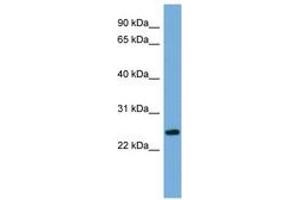 Image no. 1 for anti-Protein FAM164B (ZC2HC1B) (AA 35-84) antibody (ABIN6745661) (FAM164B Antikörper  (AA 35-84))