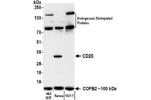 Western Blotting (WB) image for anti-Biotin antibody (ABIN7795729) (Rekombinanter Biotin Antikörper)