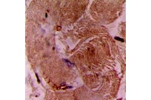 Immunohistochemical analysis of cTnI staining in human heart formalin fixed paraffin embedded tissue section.