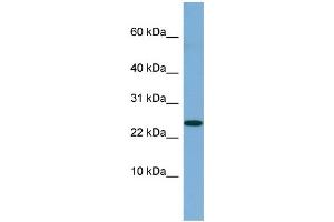 WB Suggested Anti-NBL1 Antibody Titration: 0. (NBL1 Antikörper  (Middle Region))