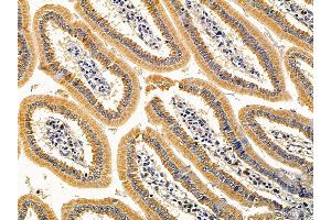 ABIN7093988 and ABIN7098032 at 1/100 staining mouse colorectal tissue by IHC-P. (Sphingomyelin Synthase 1 Antikörper  (N-Term))