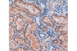 IHC-P analysis of kidney tissue, with DAB staining. (ALDH7A1 Antikörper  (AA 1-539))