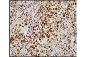 Immunohistochemistry (IHC) image for anti-Epstein-Barr Virus (EBV) (C-Term) antibody (ABIN870471) (EBV Antikörper  (C-Term))