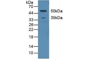 Detection of CD299 in Human Serum using Polyclonal Antibody to Cluster Of differentiation 299 (CD299) (C-Type Lectin Domain Family 4, Member M (CLEC4M) (AA 242-399) Antikörper)