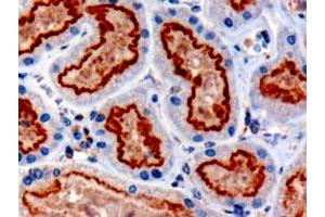 IFT88 polyclonal antibody  (3 ug/mL) staining of paraffin embedded human kidney. (IFT88 Antikörper  (C-Term))