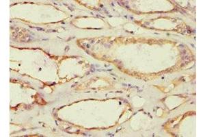 Immunohistochemistry of paraffin-embedded human kidney tissue using ABIN7142945 at dilution of 1:100 (ACAT1 Antikörper  (AA 1-145))