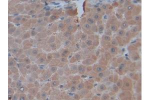 Detection of TNFSF14 in Human Liver Tissue using Polyclonal Antibody to Tumor Necrosis Factor Ligand Superfamily, Member 14 (TNFSF14) (TNFSF14 Antikörper  (AA 62-240))