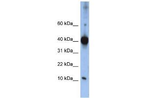 Western Blotting (WB) image for anti-LSM4 Homolog, U6 Small Nuclear RNA Associated (LSM4) antibody (ABIN2458525) (LSM4 Antikörper)