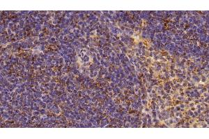 Immunohistochemistry (IHC) image for anti-Matrix Metallopeptidase 9 (Gelatinase B, 92kDa Gelatinase, 92kDa Type IV Collagenase) (MMP9) (AA 108-508) antibody (ABIN7445843)