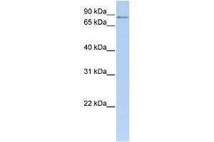 WB Suggested Anti-MTO1 Antibody Titration: 0.