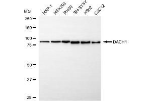 Western blotting analysis using DACH1 antibody (ABIN7798272).