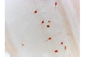 Formalin-fixed and paraffin embedded chicken testis tissue labeled with Anti-Neurturin Polyclonal Antibody, Unconjugated (ABIN724505) 1:200 followed by conjugation to the secondary antibody and DAB staining (Neurturin Antikörper  (AA 151-197))