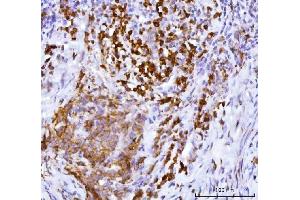 IHC analysis of APP-1/PABPC4 using anti-APP-1/PABPC4 antibody (ABIN7603019).