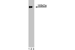 Western blot analysis of Desmoglein on a HeLa cell lysate (Human cervical epitheloid carcinoma, ATCC CCL-2. (Desmoglein (AA 705-1029) Antikörper)