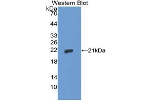 Western blot analysis of the recombinant protein. (Thimet Oligopeptidase 1 Antikörper  (AA 451-597))