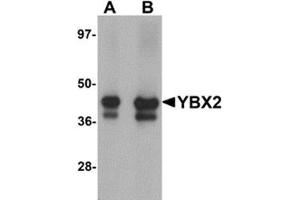 Western blot analysis of YBX2 in human testis tissue lysate with YBX2 antibody at (A) 1 and (B) 2 μg/ml. (YBX2 Antikörper  (C-Term))