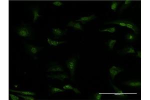 Immunofluorescence of monoclonal antibody to PDE5A on HeLa cell. (PDE5A Antikörper  (AA 29-138))