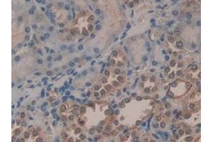 Detection of PGA in Human Kidney Tissue using Polyclonal Antibody to Pepsinogen A (PGA) (Pepsinogen A Antikörper  (AA 63-295))