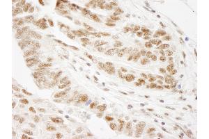 Immunohistochemistry (IHC) image for anti-Wilms Tumor 1 Associated Protein (WTAP) (AA 346-396) antibody (ABIN7449036) (WTAP Antikörper  (AA 346-396))