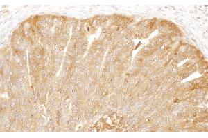 Immunohistochemistry (IHC) image for anti-CAP, Adenylate Cyclase-Associated Protein 1 (CAP1) (AA 275-325) antibody (ABIN7455049)