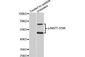 Western Blotting (WB) image for anti-Microtubule-Associated Protein tau (MAPT) (pSer396) antibody (ABIN3019683) (MAPT Antikörper  (pSer396))