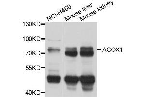 Western blot analysis of extracts of various cell lines, using ACOX1 antibody. (ACOX1 Antikörper)