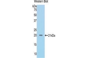 Western blot analysis of the recombinant protein. (ACVR2A Antikörper  (AA 326-485))