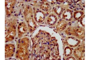 IHC image of ABIN7157624 diluted at 1:400 and staining in paraffin-embedded human kidney tissue performed on a Leica BondTM system. (KIF22 Antikörper  (AA 34-169))