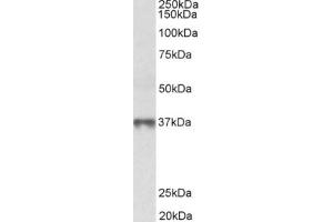 Western Blotting (WB) image for anti-Methionine Adenosyltransferase II, beta (MAT2B) (Isoform 1), (N-Term) antibody (ABIN2465101) (MAT2B Antikörper  (Isoform 1, N-Term))