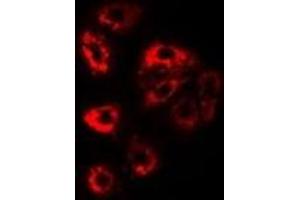 Immunofluorescent analysis of PSMD9 staining in Jurkat cells. (PSMD9 Antikörper)