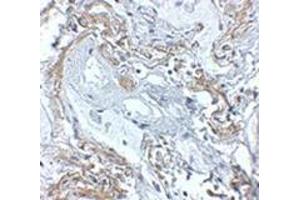 Immunohistochemistry of TNFAIP3 in human lung tissue with this product at 5 μg/ml. (TNFAIP3 Antikörper  (C-Term))