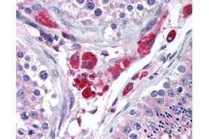 Anti-HIPK3 antibody IHC of human testis. (HIPK3 Antikörper  (AA 850-900))