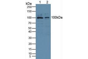 Figure. (PLA2G4A Antikörper  (AA 563-749))