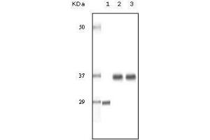 Western blot analysis using SRA mouse mAb against truncated SRA recombinant protein (1), human ovary cancer tissue lysate (2) and A431 cell lysate (3). (SRA1 Antikörper)