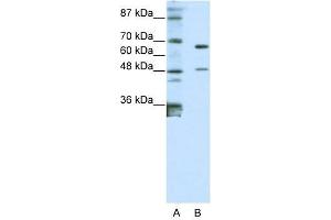 Western Blot showing ZNF597 antibody used at a concentration of 1-2 ug/ml to detect its target protein. (ZNF597 Antikörper  (N-Term))