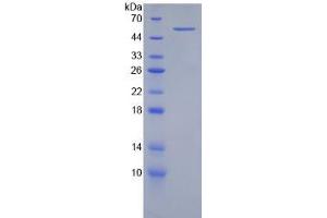 SDS-PAGE analysis of Human Integrin beta 2 Protein.