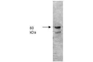 Image no. 1 for anti-Intestinal Alkaline Phosphatase (ALPI) antibody (ABIN799740) (Intestinal Alkaline Phosphatase Antikörper)